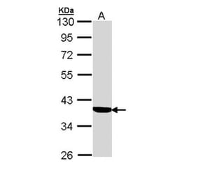 Cortisol Binding Globulin antibody from Signalway Antibody (22386) - Antibodies.com