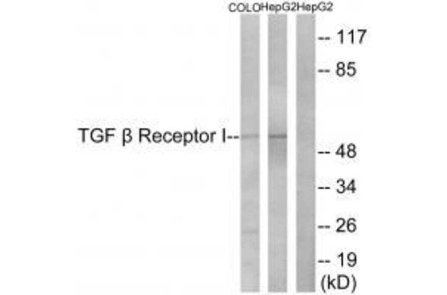 Western blot - TGF β Receptor I (Ab-165) Antibody from Signalway Antibody (33175) - Antibodies.com