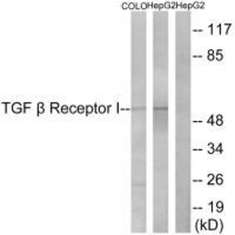 Western blot - TGF β Receptor I (Ab-165) Antibody from Signalway Antibody (33175) - Antibodies.com