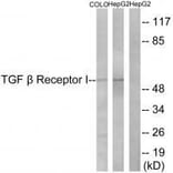 Western blot - TGF β Receptor I (Ab-165) Antibody from Signalway Antibody (33175) - Antibodies.com
