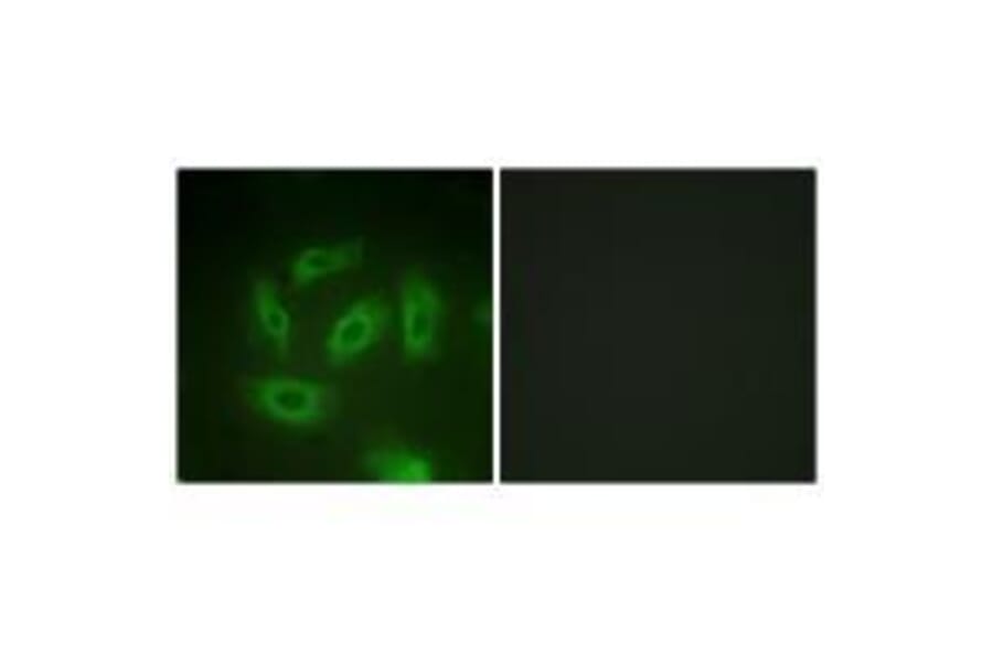 Immunofluorescence - TGF β Receptor I (Ab-165) Antibody from Signalway Antibody (33175) - Antibodies.com