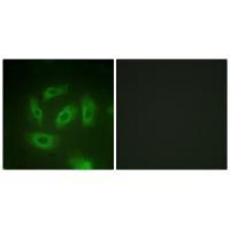 Immunofluorescence - TGF β Receptor I (Ab-165) Antibody from Signalway Antibody (33175) - Antibodies.com
