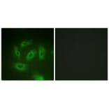 Immunofluorescence - TGF β Receptor I (Ab-165) Antibody from Signalway Antibody (33175) - Antibodies.com