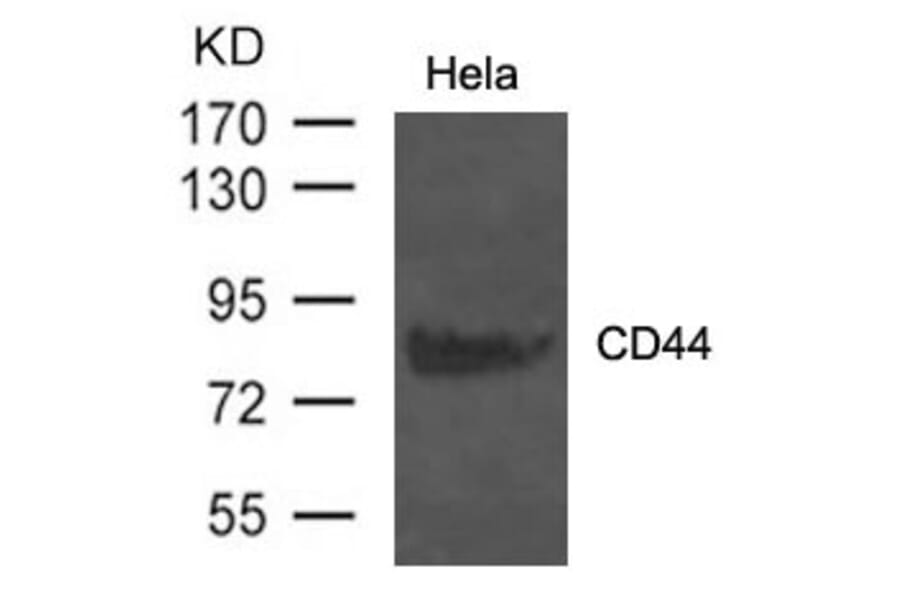 Western blot - CD44 Antibody from Signalway Antibody (21471) - Antibodies.com