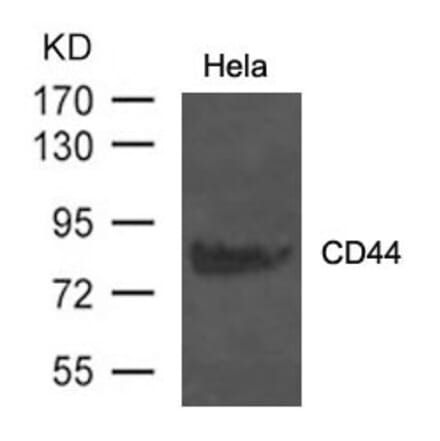 Western blot - CD44 Antibody from Signalway Antibody (21471) - Antibodies.com