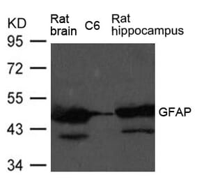 Western blot - GFAP Antibody from Signalway Antibody (21485) - Antibodies.com