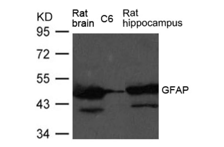 Western blot - GFAP Antibody from Signalway Antibody (21485) - Antibodies.com