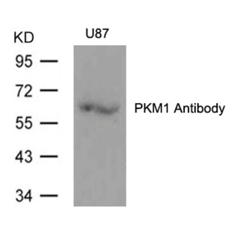 Western blot - PKM1 Antibody from Signalway Antibody (21577) - Antibodies.com