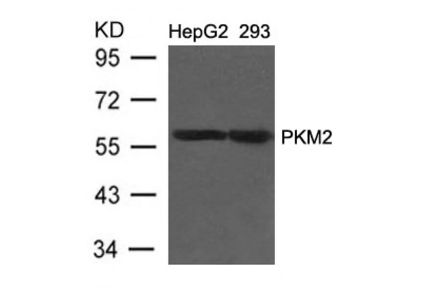 Western blot - PKM2 Antibody from Signalway Antibody (21578) - Antibodies.com