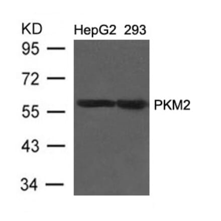 Western blot - PKM2 Antibody from Signalway Antibody (21578) - Antibodies.com