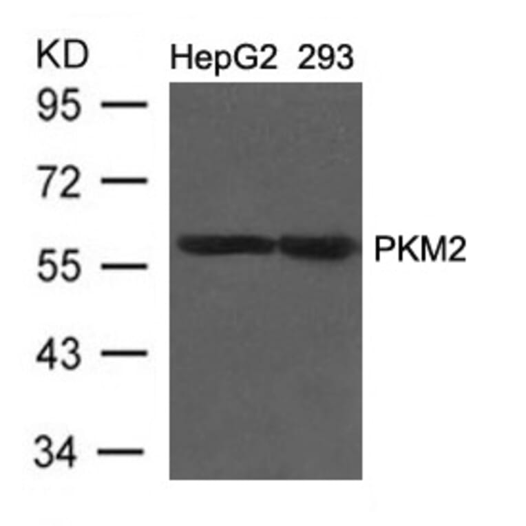 Western blot - PKM2 Antibody from Signalway Antibody (21578) - Antibodies.com