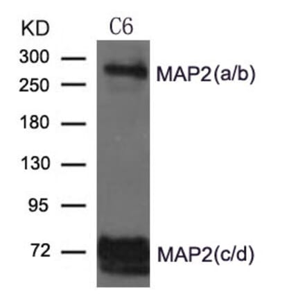Western blot - MAP2 Antibody from Signalway Antibody (21636) - Antibodies.com