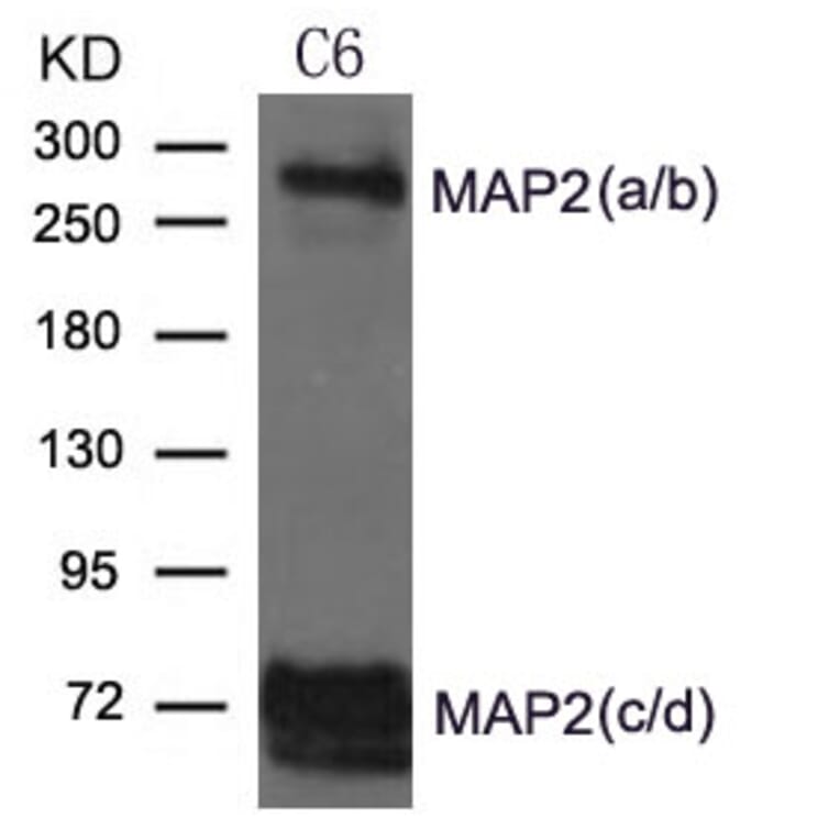 Western blot - MAP2 Antibody from Signalway Antibody (21636) - Antibodies.com