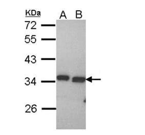 PECR antibody from Signalway Antibody (22145) - Antibodies.com