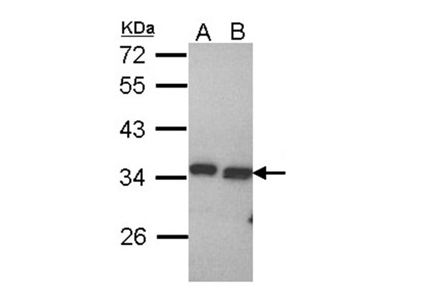 PECR antibody from Signalway Antibody (22145) - Antibodies.com