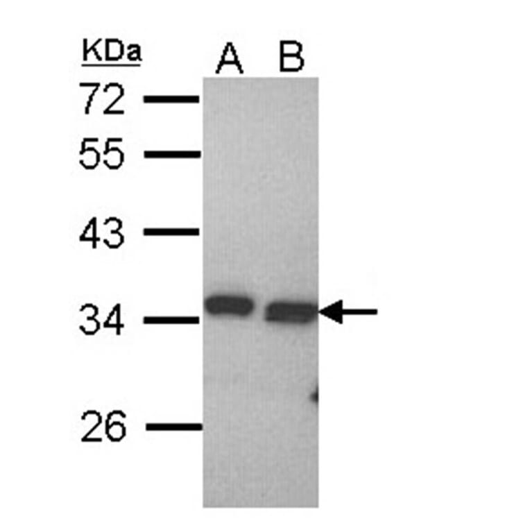 PECR antibody from Signalway Antibody (22145) - Antibodies.com