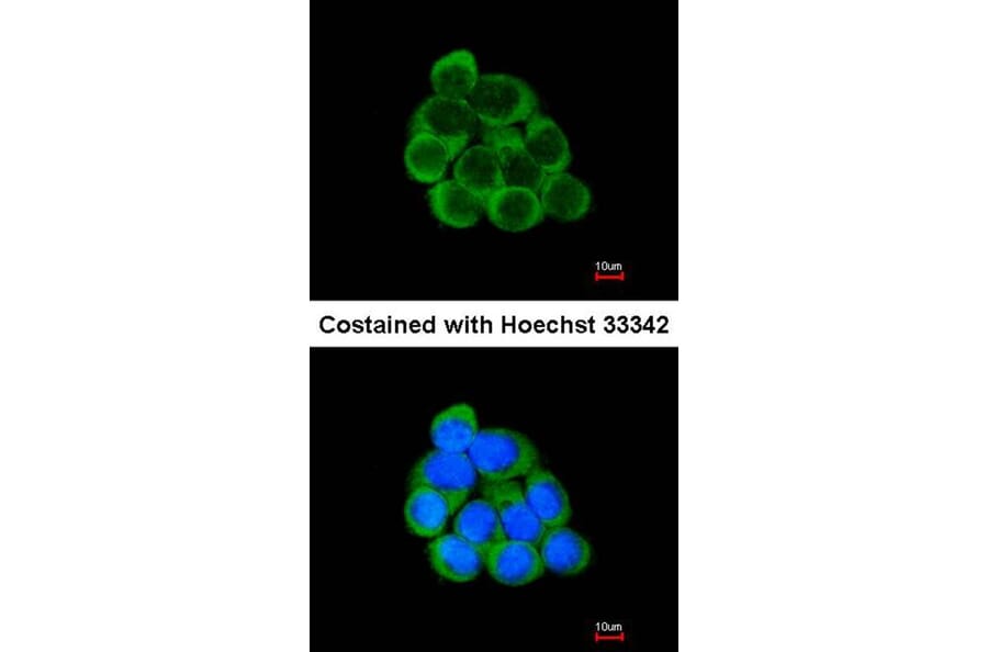 Immunofluorescence - PECR antibody from Signalway Antibody (22145) - Antibodies.com