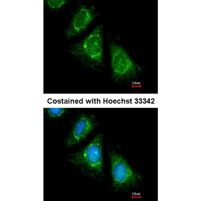 Immunofluorescence - PAN3 antibody from Signalway Antibody (22199) - Antibodies.com