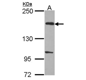 EVC2 antibody from Signalway Antibody (22218) - Antibodies.com