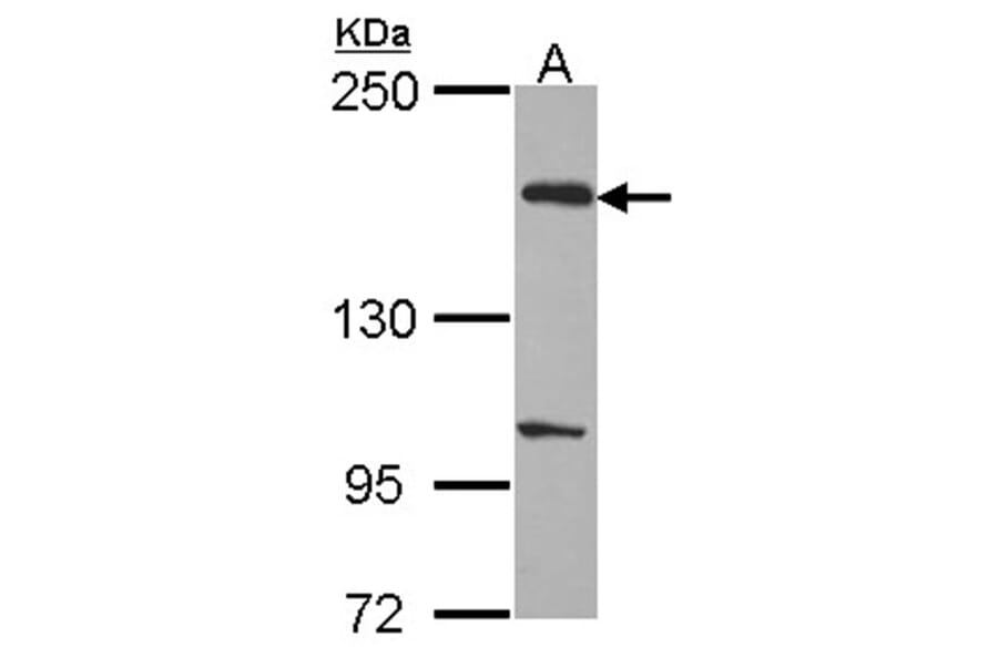 EVC2 antibody from Signalway Antibody (22218) - Antibodies.com