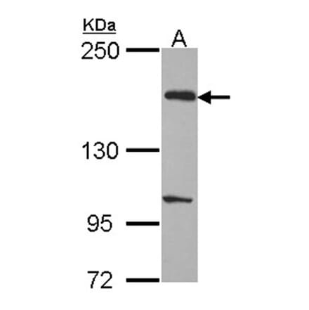 EVC2 antibody from Signalway Antibody (22218) - Antibodies.com