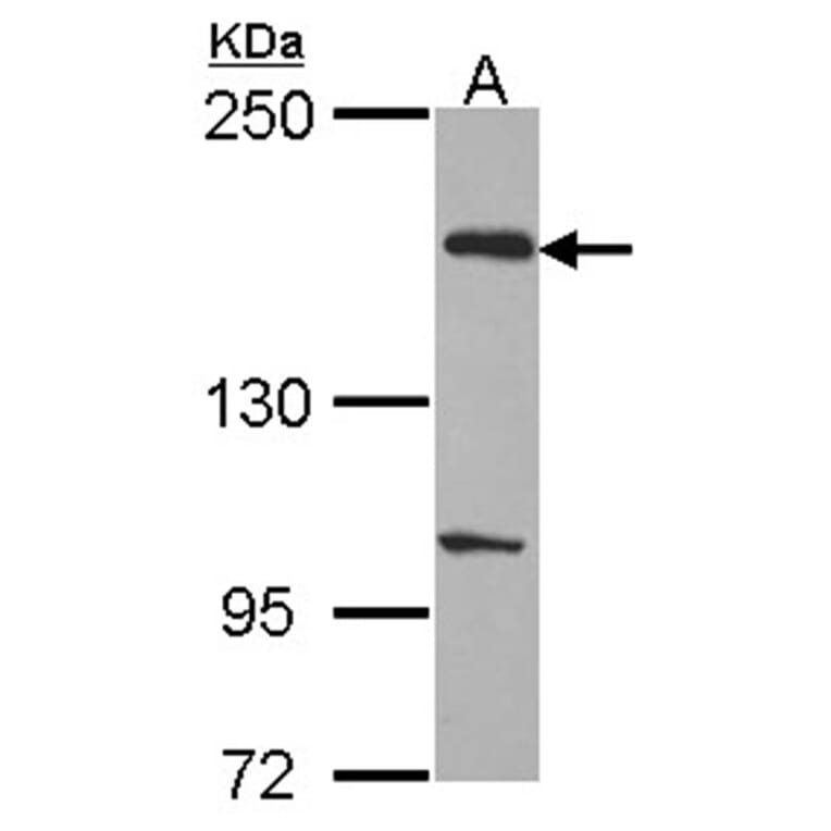 EVC2 antibody from Signalway Antibody (22218) - Antibodies.com