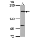 EVC2 antibody from Signalway Antibody (22218) - Antibodies.com
