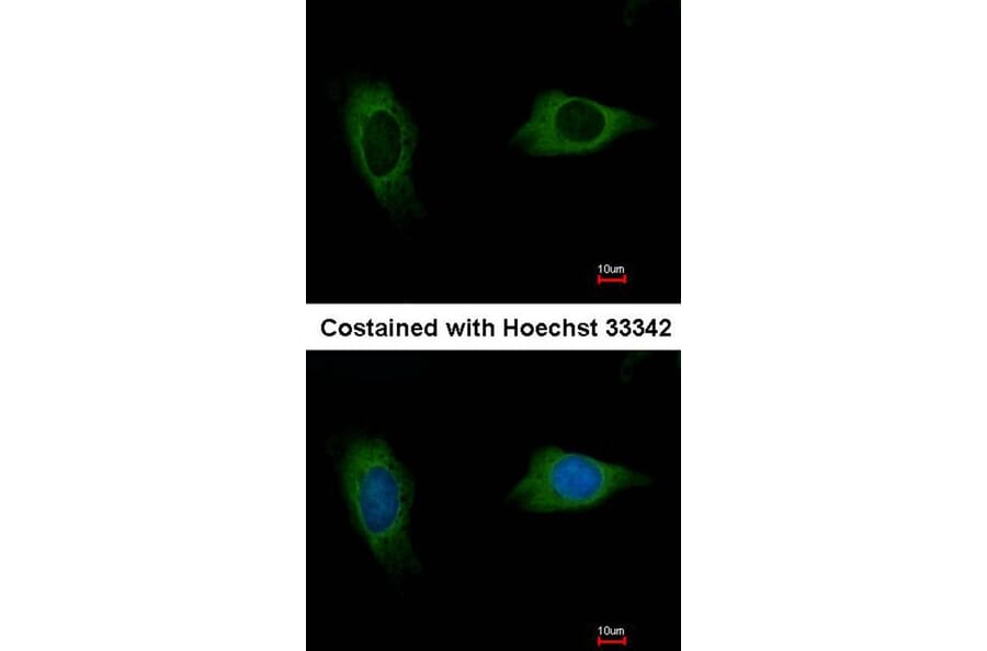 Immunofluorescence - EVC2 antibody from Signalway Antibody (22218) - Antibodies.com
