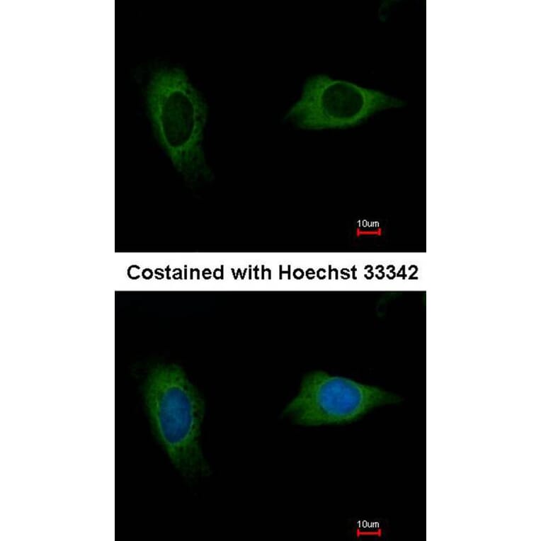 Immunofluorescence - EVC2 antibody from Signalway Antibody (22218) - Antibodies.com