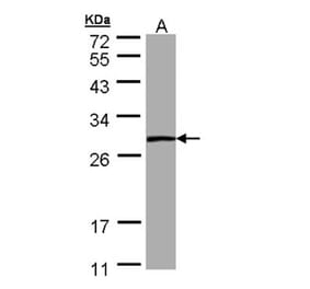 PSPH antibody from Signalway Antibody (22302) - Antibodies.com