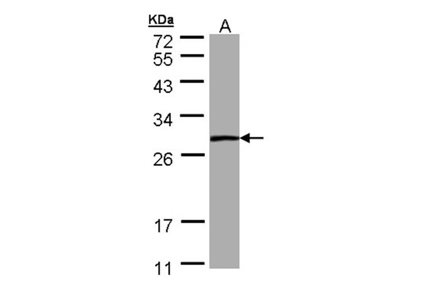 PSPH antibody from Signalway Antibody (22302) - Antibodies.com
