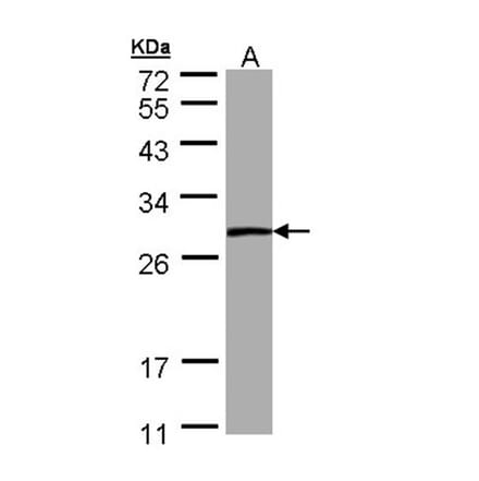 PSPH antibody from Signalway Antibody (22302) - Antibodies.com