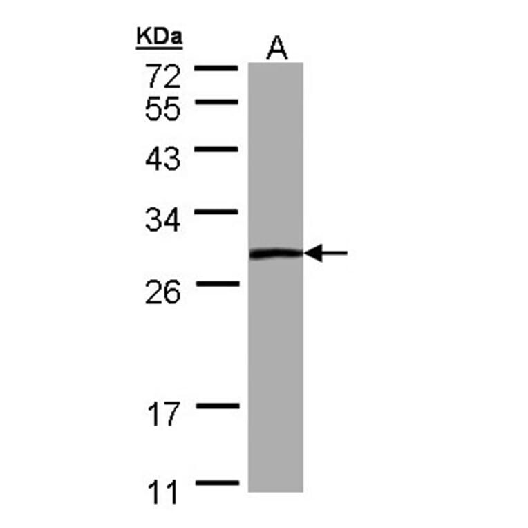 PSPH antibody from Signalway Antibody (22302) - Antibodies.com