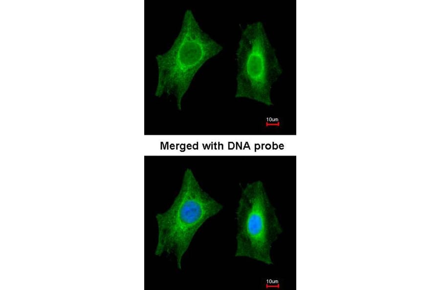Immunofluorescence - PSPH antibody from Signalway Antibody (22302) - Antibodies.com