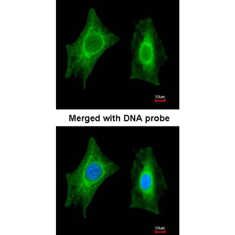 Immunofluorescence - PSPH antibody from Signalway Antibody (22302) - Antibodies.com