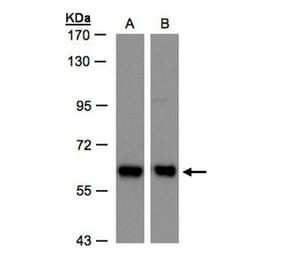 COPD antibody from Signalway Antibody (22506) - Antibodies.com