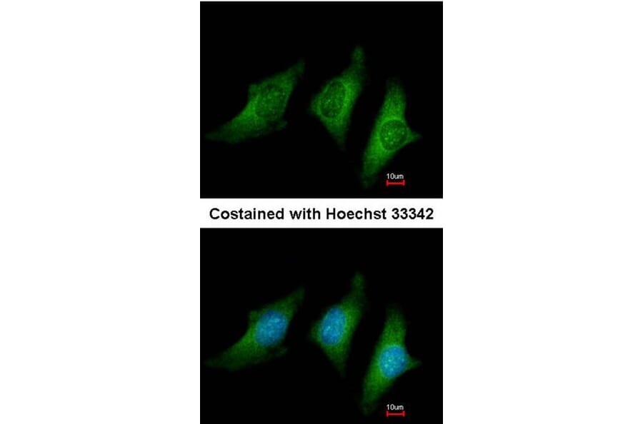 Immunofluorescence - CD55 antibody from Signalway Antibody (22513) - Antibodies.com