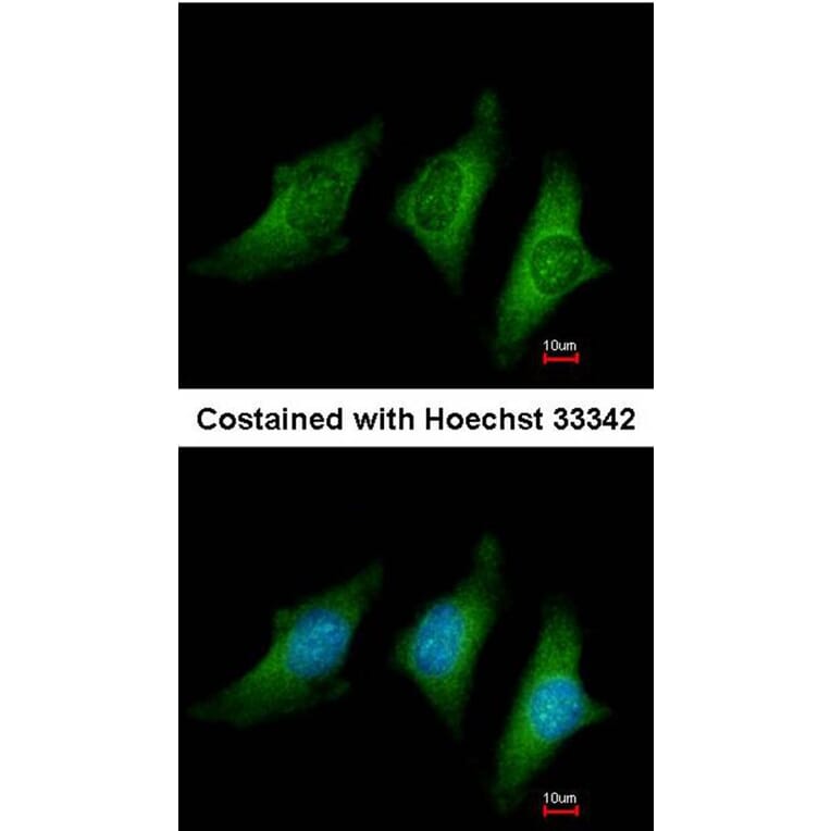 Immunofluorescence - CD55 antibody from Signalway Antibody (22513) - Antibodies.com