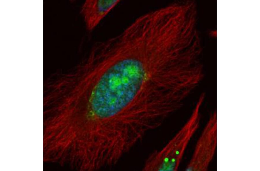 UTP6 antibody from Signalway Antibody (22514) - Antibodies.com