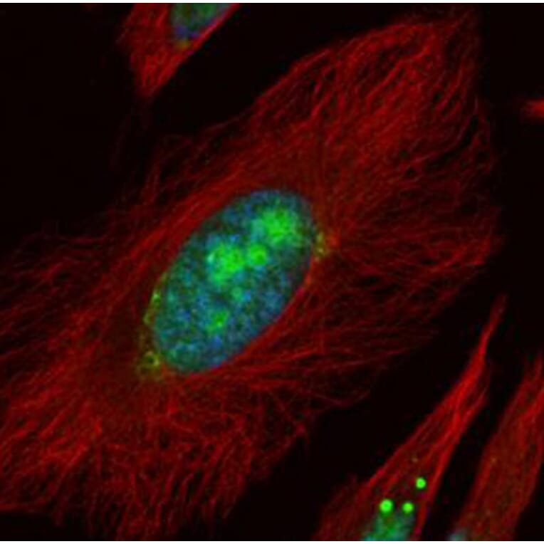 UTP6 antibody from Signalway Antibody (22514) - Antibodies.com