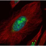 UTP6 antibody from Signalway Antibody (22514) - Antibodies.com