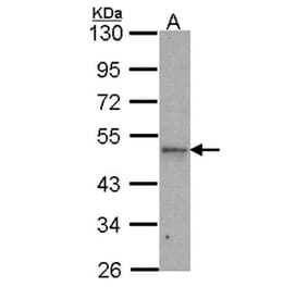 IPMK antibody from Signalway Antibody (22522) - Antibodies.com