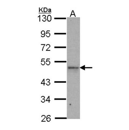 IPMK antibody from Signalway Antibody (22522) - Antibodies.com