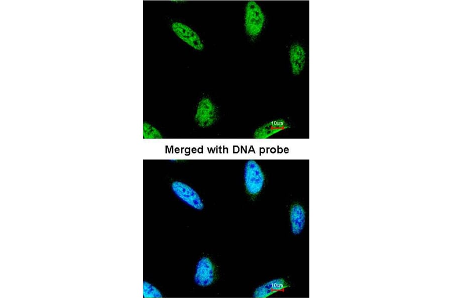 Immunofluorescence - IPMK antibody from Signalway Antibody (22522) - Antibodies.com