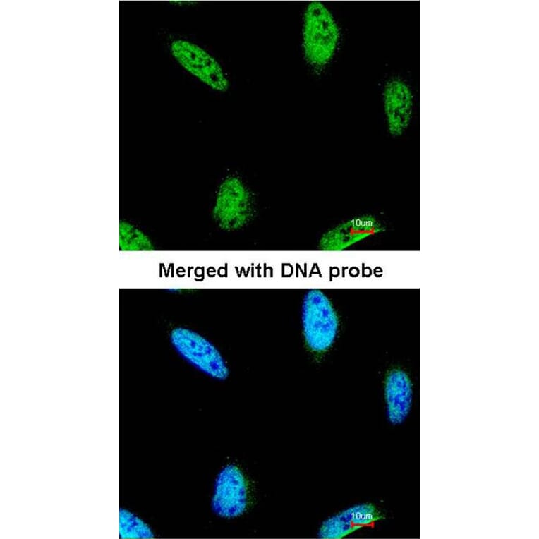 Immunofluorescence - IPMK antibody from Signalway Antibody (22522) - Antibodies.com