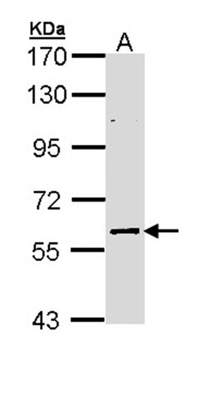 Sample (30 µg of whole cell lysate)  NT2D1B: IMR32 7.5% SDS PAGE ELP3 antibody diluted at 1: 2000