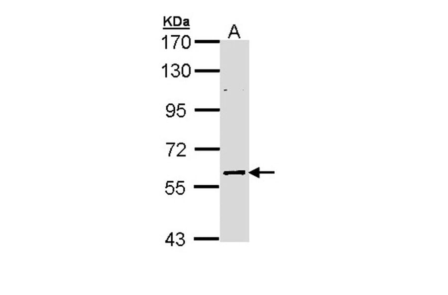 ELP3 antibody from Signalway Antibody (22597) - Antibodies.com