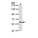 ELP3 antibody from Signalway Antibody (22597) - Antibodies.com