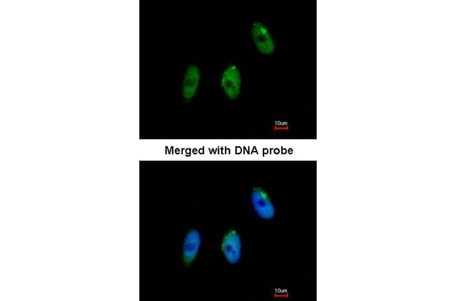 Immunofluorescence - ELP3 antibody from Signalway Antibody (22597) - Antibodies.com