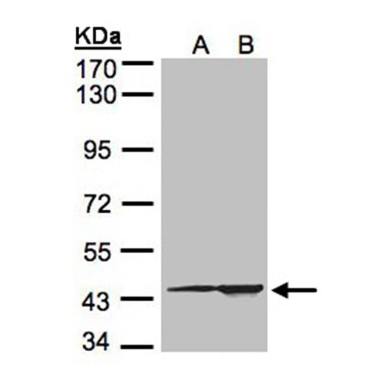 CMAS antibody from Signalway Antibody (22683) - Antibodies.com
